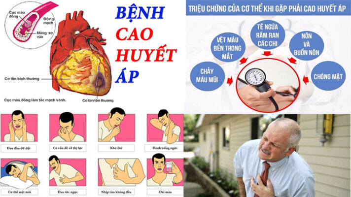 Bệnh cao huyết áp